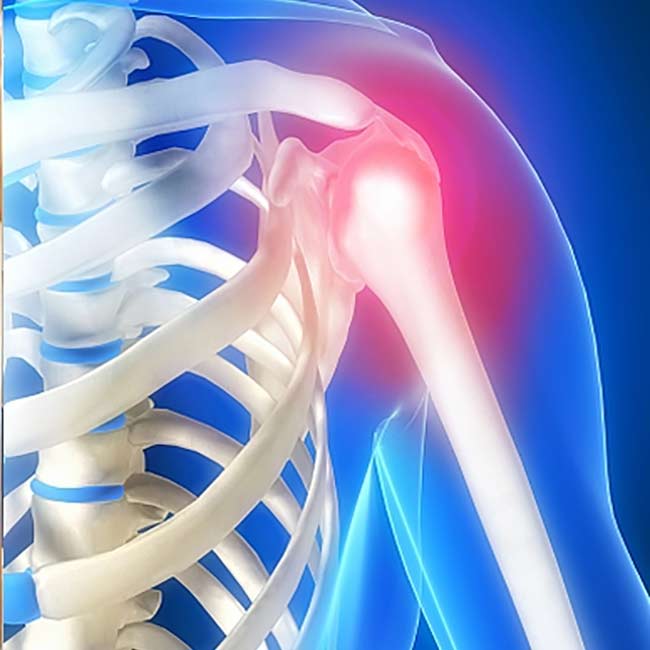 قرص استئوفیت برای جلوگیری از پوکی استخوان