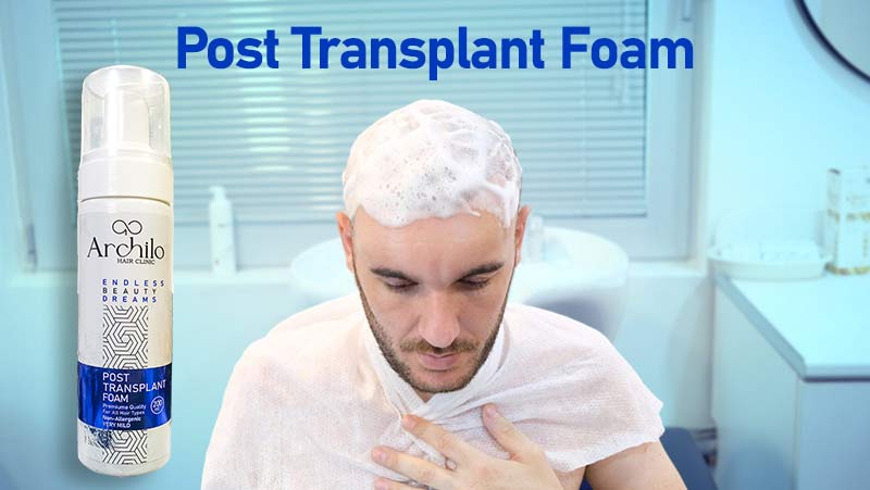 فوم بعد از کاشت موی آرچیلو
