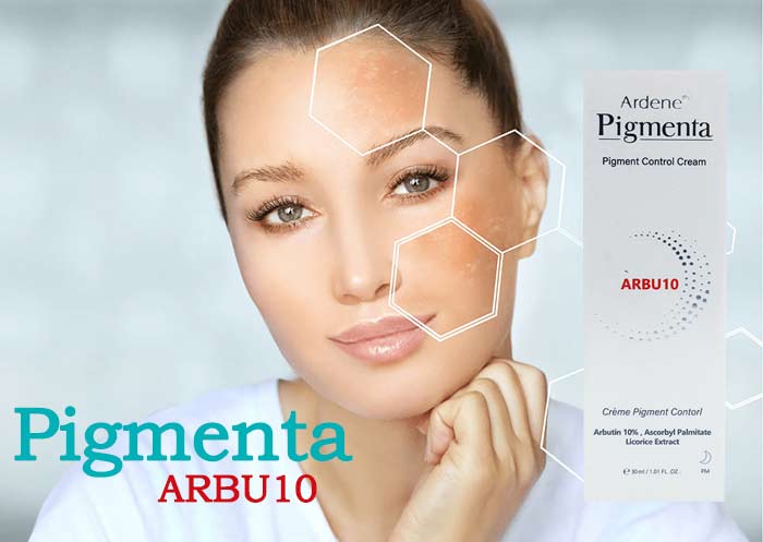 کرم روشن کننده و ضدلک قوی پیگمنتا مدل آربوتین 10 درصد