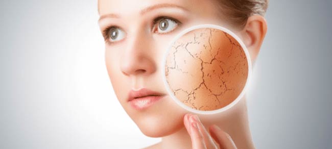 رفع خشکی پوست با اورلین کامفورت فارمد سلامت سینا