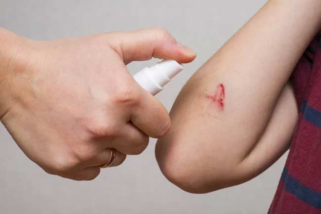 اسپری هگزاسپت بتاسپت