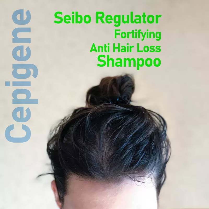 شامپو ضد ریزش موی چرب سپیژن