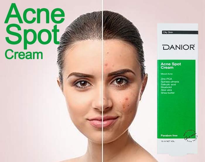 کرم ضد جوش و آکنه دنیور برای پوست چرب در داروکالا