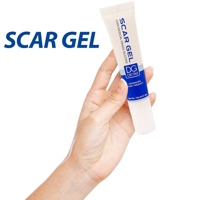 اسکار ژل برای چیست