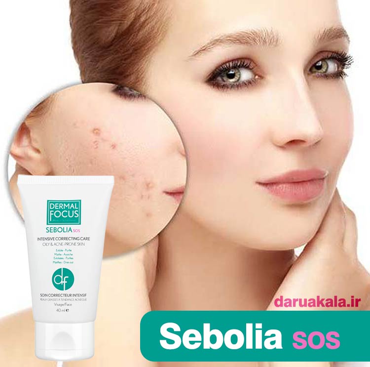 ژل ضد جوش سبولیا SOS درمال فوکوس