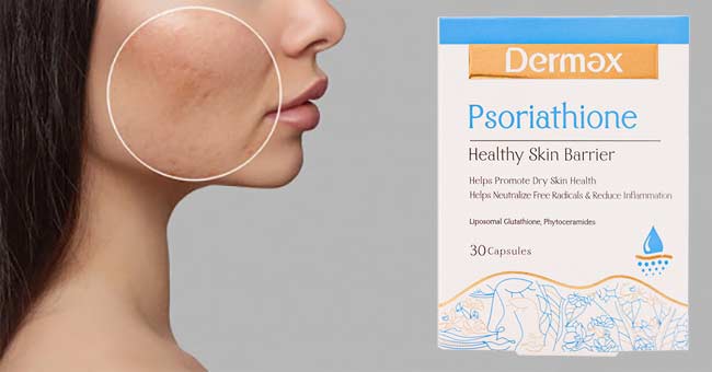 کپسول سوریاتیون درمکس