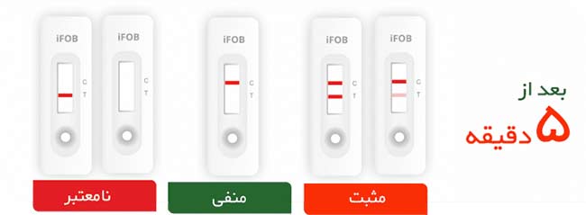 نمایش نتیجه کیت تشخیص تست سرطان روده