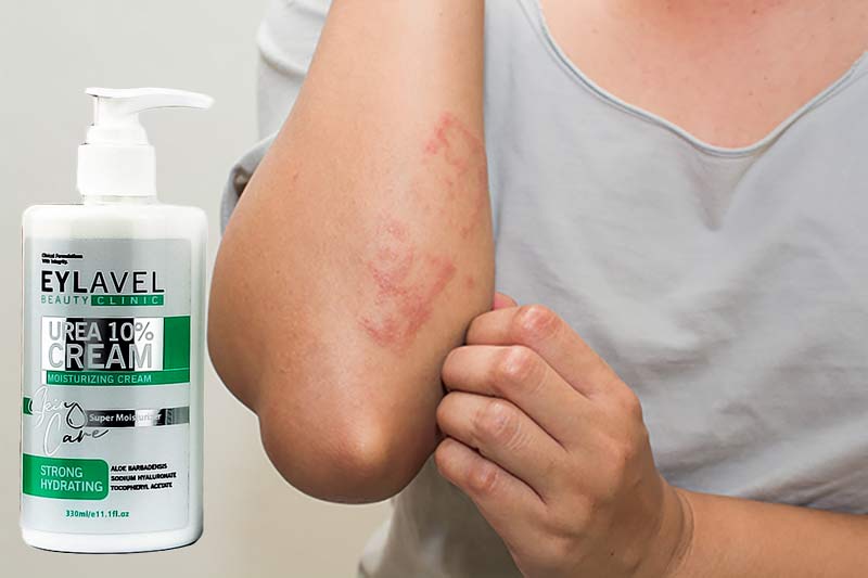 کرم مرطوب کننده اوره 10 درصد ایلاول