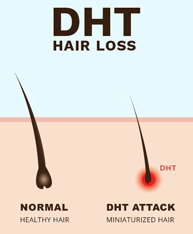نقش اینوزیتول در جلوگیری از ریزش مو