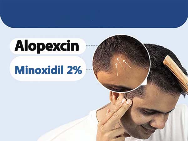 محلول ضد ریزش موی ماینوکسیدیل 2 درصد 