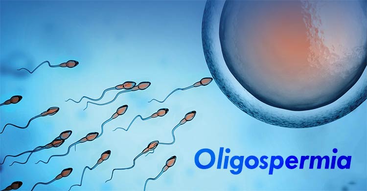 الیگو اسپرمی چیست؟