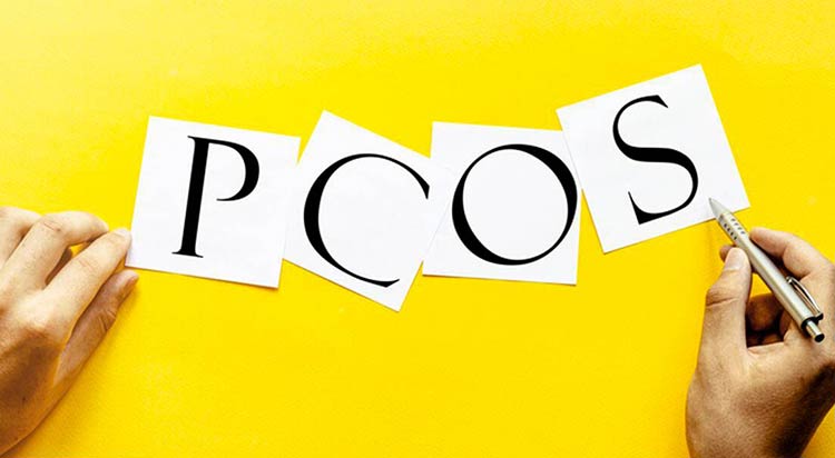 درمان سندرم بیماری کیست تخمدان PCOS