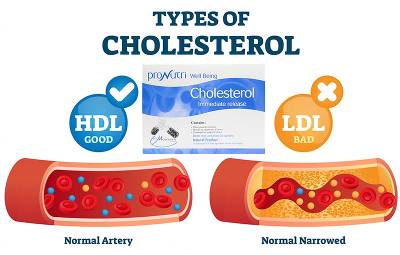 کپسول پرونوتری ولبیینگ کلسترول رستا ایمن دارو
