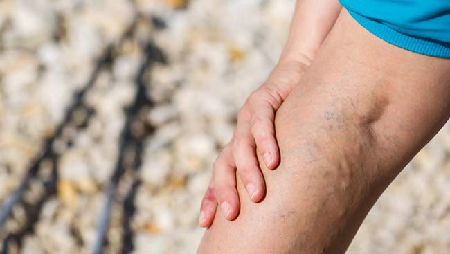 کپسول مولتی ویتامین و مینرال ویتالی تون