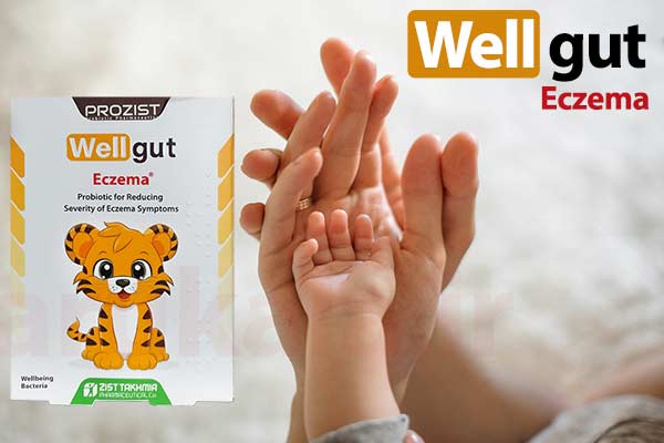 ساشه ول گات اگزما زیست تخمیر