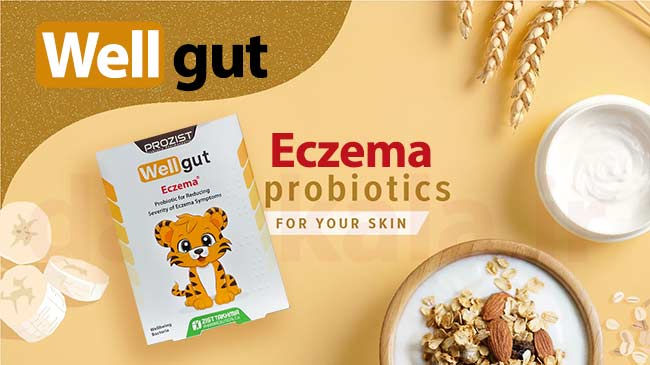 ول گات اگزما