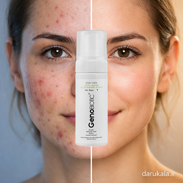 قیمت فوم ضد جوش و آکنه ژنوبایوتیک