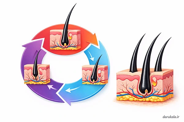 درمان سریع ریزش مو