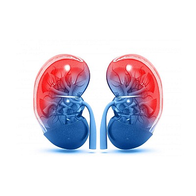 سنگ کلیه و رواتینکس(Rowatinex)