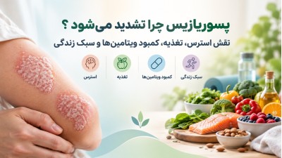 پسوریازیس چرا تشدید می‌شود؟ نقش استرس، تغذیه، کمبود ویتامین‌ها و سبک زندگی