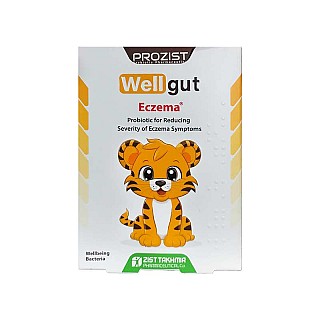 ول گات اگزما