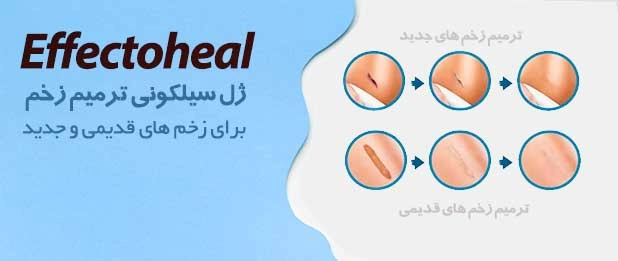 خرید ژل ترمیم کننده افکتوهیل