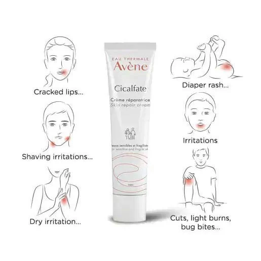 Cicalfate Cream