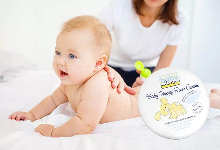 کرم ادرار سوختگی کودک بی بی لاین