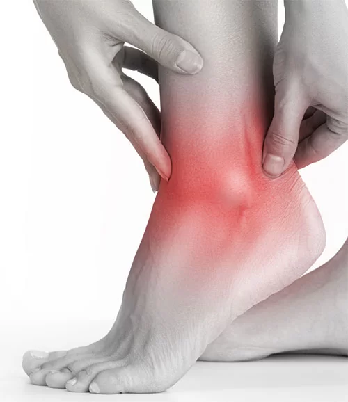بررسی علل درد قوزک پا در داروخانه آنلاین دارو کالا