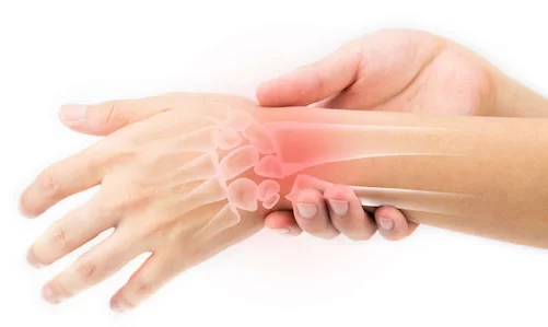 مچ بند اپو مدل 1081