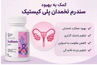 درمان سندروم تخمدان پلی کیستیک با اووابلوم