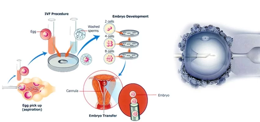 نحوه عملکرد آمپول پیورگان
