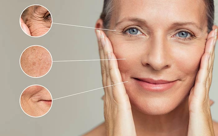 مزایای مصرف کلاژن هیدرولیز شده بر روی پوست