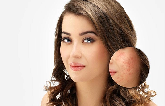 خرید کرم لایه بردار سینره
