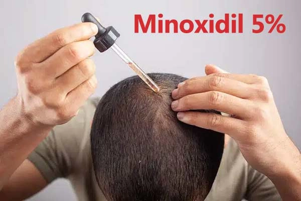 آلوپکسین پنج درصد اوکسین دارو وشت