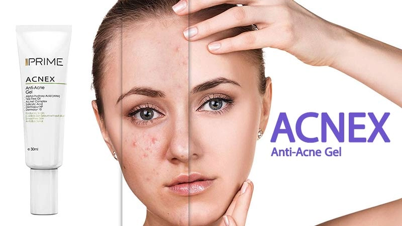 ژل ضد جوش پریم مدل آکنکس ACNEX