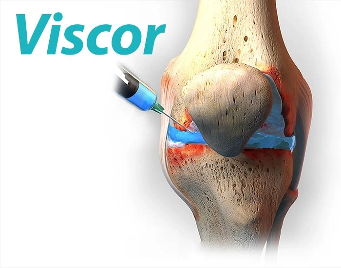 viscor