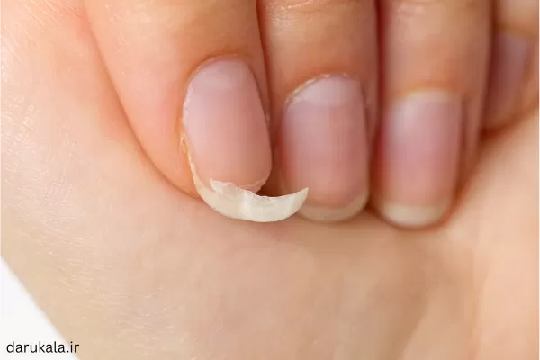 بهترین زمان مصرف سوزین 25