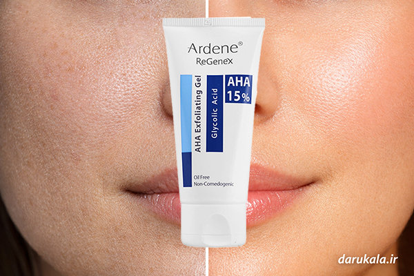 خرید ژل آلفا هیدروکسی اسید 15 درصد آردن