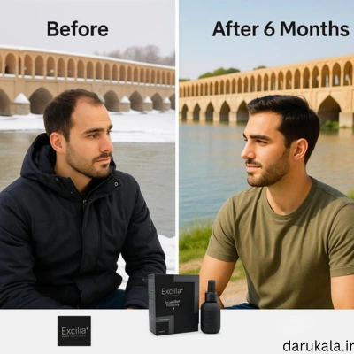 ااکسیلیا برای تقویت مو