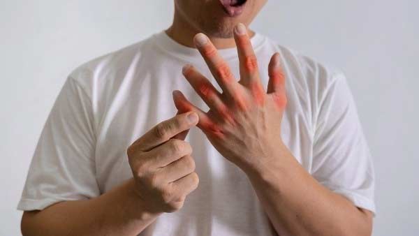 کرم حاوی عصاره آرنیکا لافارر