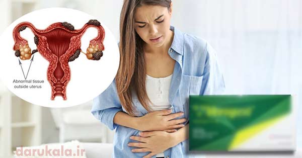 درمان آندومتریوز با وروژست